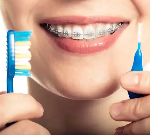 Diş Sıkma ve Gıcırdatma (Bruksizm) Nedir? Belirtiler ve Tedavi Yöntemleri