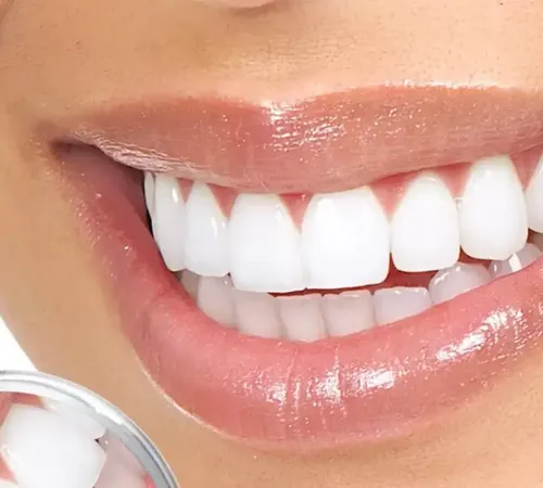 Bursa Diş Eti Uzmanı | Periodontal Tedavi ve Diş Eti Hastalıkları