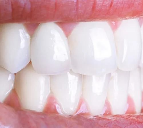 Bursa Diş Klinikleri | Güvenilir Ağız ve Diş Sağlığı Hizmetleri