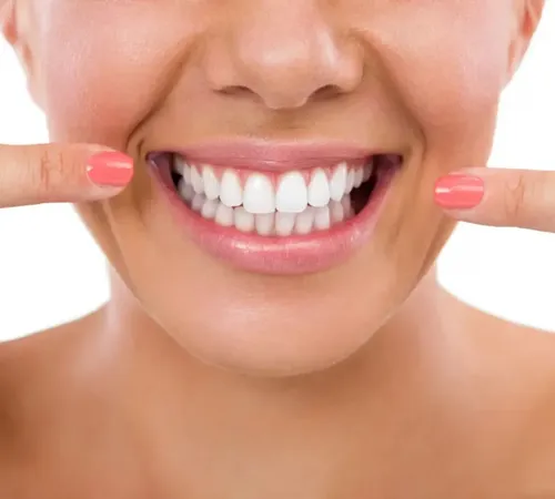 Diş Kaplama Nedir? Türleri, Avantajları ve Ne Zaman Yapılır?